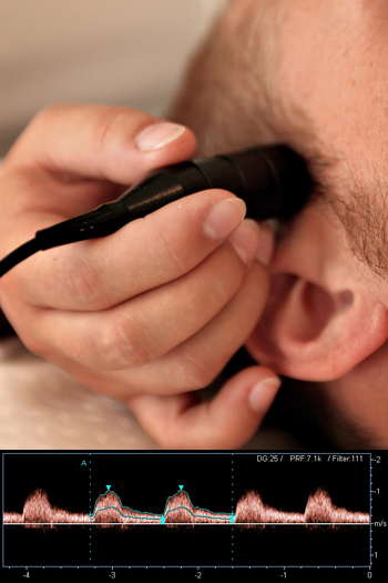 TCD - Transcranial Doppler, Neurologist, Dubai, UAE TCD - Transcranial Doppler, Neurologist, Dubai, UAE