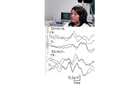 قياس الاستثارة السمعية