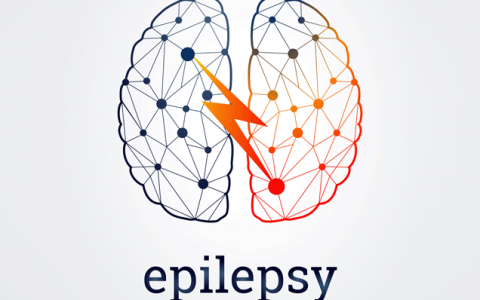 Epilepsy, Seizures, Convulsions