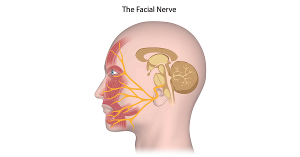 facial nerve palsy dubai