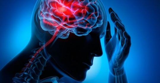 Causes, Signs and Symptoms of Strokes
