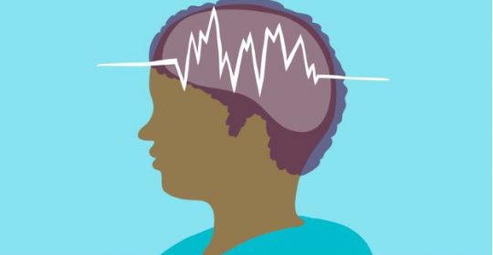 Epilepsy: Causes, Symptoms and Treatments