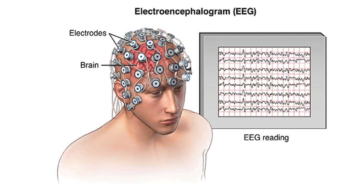 eeg electroencephalography dubai